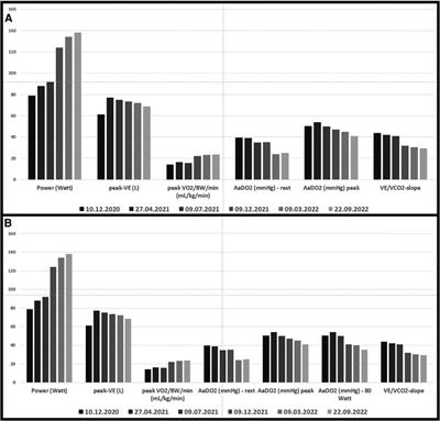 Successful simultaneous stenting of a pulmonary artery and vein in pulmonary vascular stenosis due to silicosis. Case report and literature review